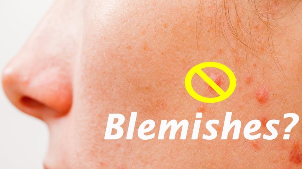 Cure Blemishes at Home