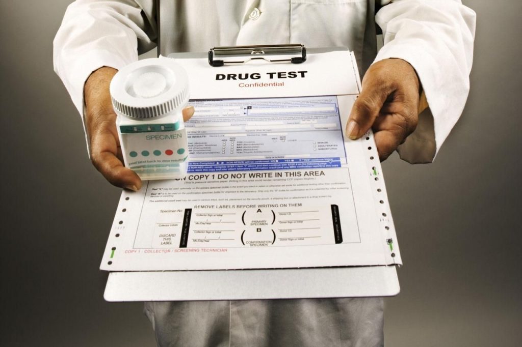 How to Pass a Drug Test Fast?