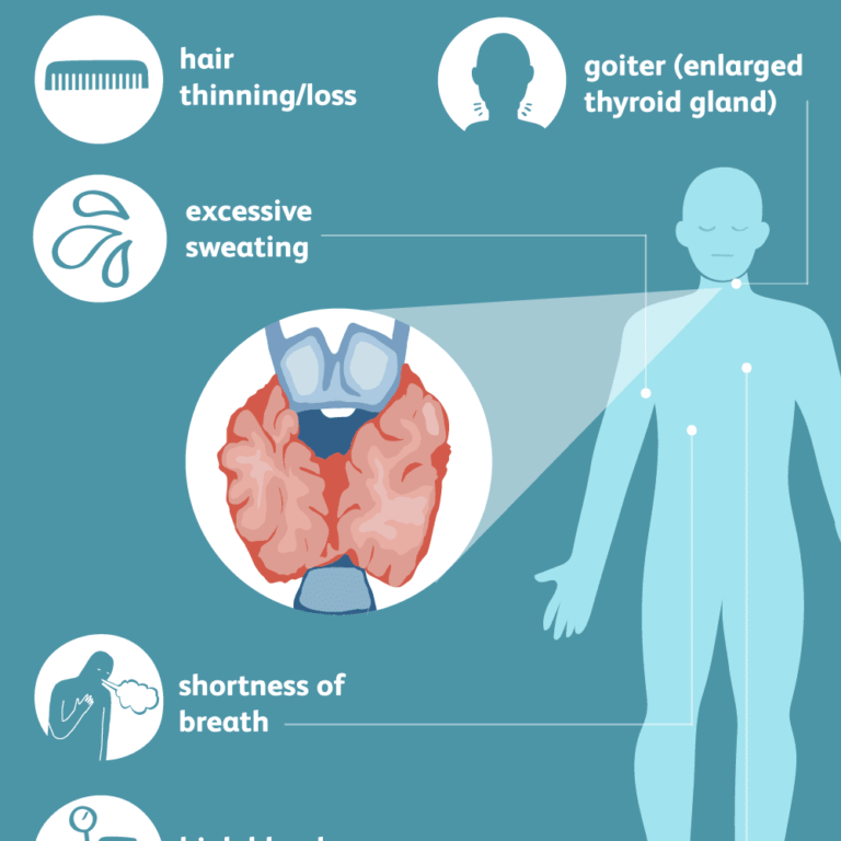 Effects of Low Thyroid Levels in the Body