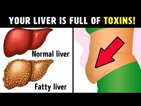 10 warning sign that your liver is full of toxins.2