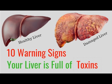 10 warning sign that your liver is full of toxins