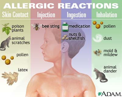 what causes allergies